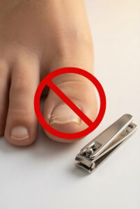 Mehr über den Artikel erfahren Nägel mit der Zange abzwicken!